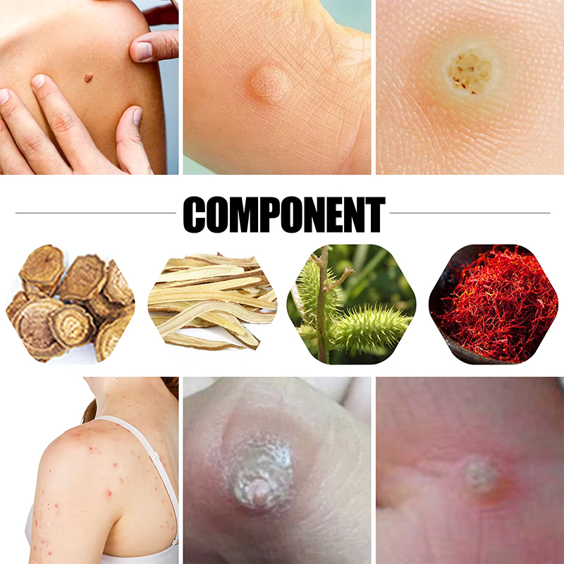 Pure Herbal Foot Care Patch Pure Herbal Foot Care Patch